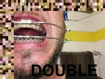 Horny deepthroat full of spit with braces and double headgear