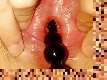 Anal bead peehole